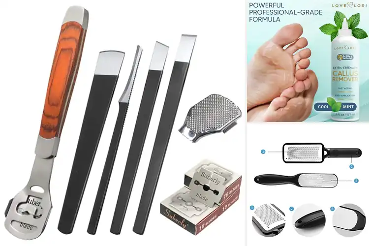 Detailed view of Best Callus Remover Tools