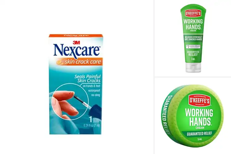 Detailed view of Best Cracked Hand Solutions: Heal & Protect Fast